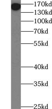 CD206 Mouse Monoclonal Antibody
