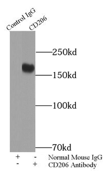 CD206 Mouse Monoclonal Antibody