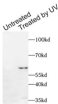 Phospho-CHEK1(S280) Antibody