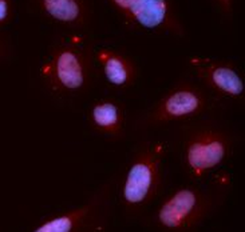 Phospho-CHEK1(S280) Antibody