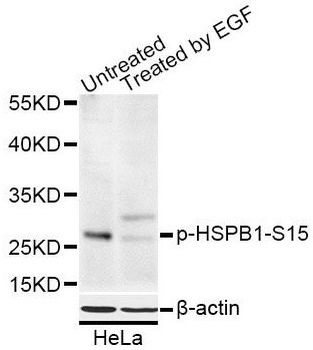 Phospho HSPB1 (S15) Rabbit Polyclonal Antibody