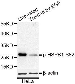 Phospho-HSPB1 (S82) Antibody