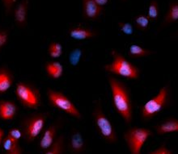 Phospho-HSPB1 (S82) Antibody