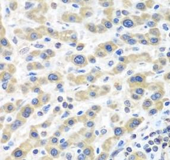 IL2 Antibody