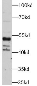 PTEN Rabbit Polyclonal Antibody