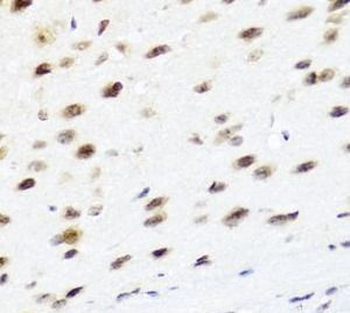 PTEN Rabbit Polyclonal Antibody
