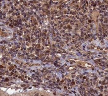TOP1 Antibody