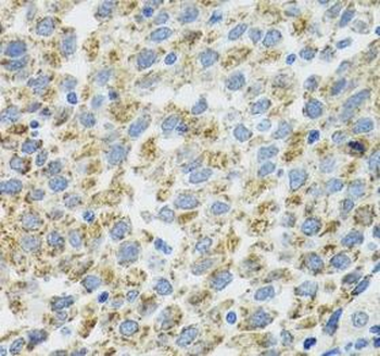 TXN2 Antibody