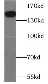 THBS2 Rabbit Polyclonal Antibody