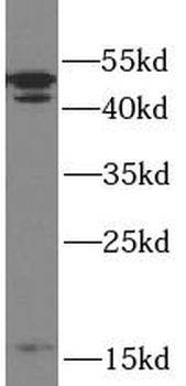 CASP2 Mouse Monoclonal Antibody