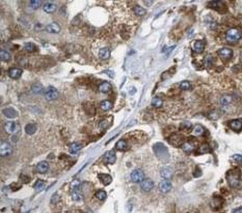 MAP3K3 Antibody