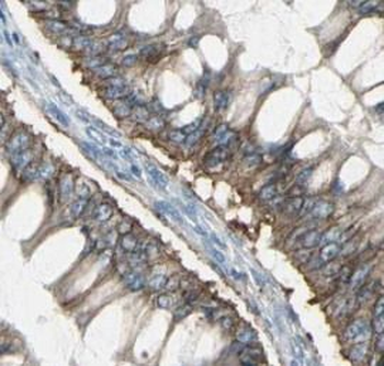 HSPA8 Mouse Monoclonal Antibody