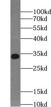MYD88 Rabbit Polyclonal Antibody