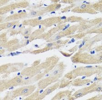 NPPA Antibody