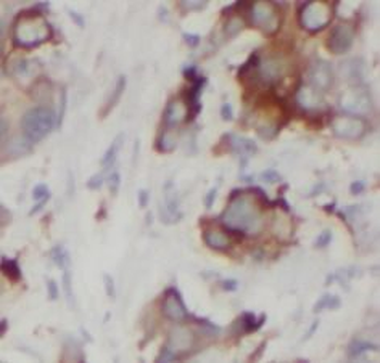 DVL1 Antibody