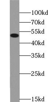 NAMPT Mouse Monoclonal Antibody
