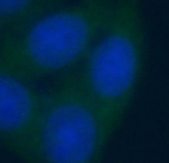 NAMPT Mouse Monoclonal Antibody