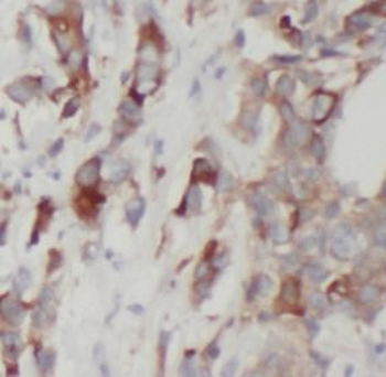 NAMPT Mouse Monoclonal Antibody