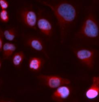 ATP7B Antibody