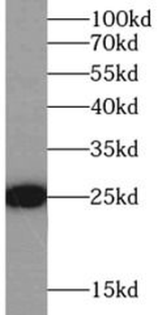 GSTP1 Antibody