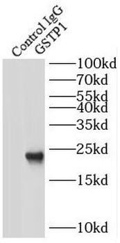 GSTP1 Antibody