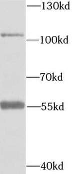 EPHA2 Antibody
