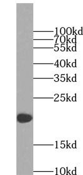 IL4 Rabbit Polyclonal Antibody