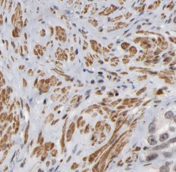 VEGFC Antibody