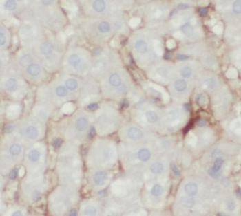 SLC2A2 Antibody