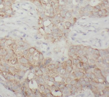 NF1 Antibody