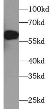 TH Mouse Monoclonal Antibody