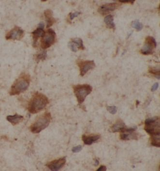 TH Mouse Monoclonal Antibody