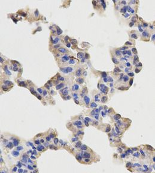 RELA Antibody
