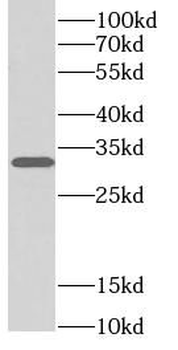 Luciferase Rabbit Polyclonal Antibody