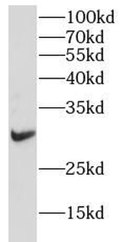 IL2RA Rabbit Polyclonal Antibody