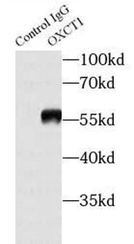 OXCT1 Antibody