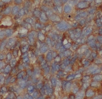 ANGPTL8 Antibody