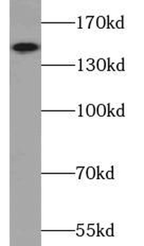 TBC1D4 Antibody