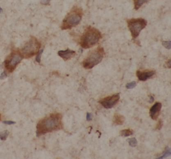 TUBB3 Antibody