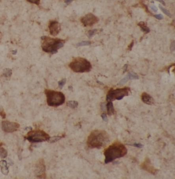 SNCA Mouse Monoclonal Antibody