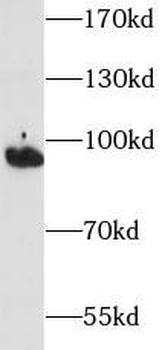 ITGB2 Rabbit Polyclonal Antibody