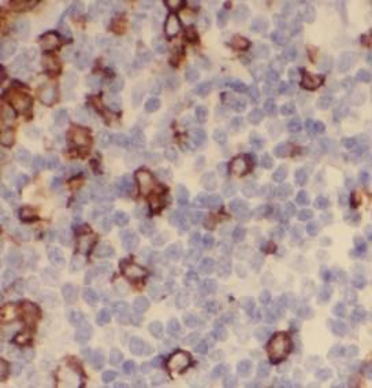 ITGB2 Rabbit Polyclonal Antibody