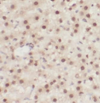 SFN Antibody