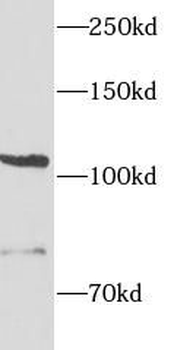 ITGAE Rabbit Polyclonal Antibody