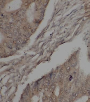JAK1 Antibody