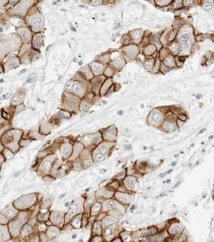SLC16A1 Antibody