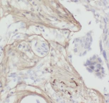 Collagen Type I Antibody