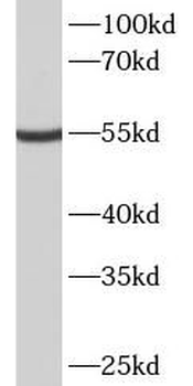 METTL4 Rabbit Polyclonal Antibody