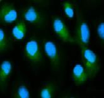 AHSG Antibody