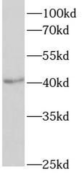 QPCT Antibody